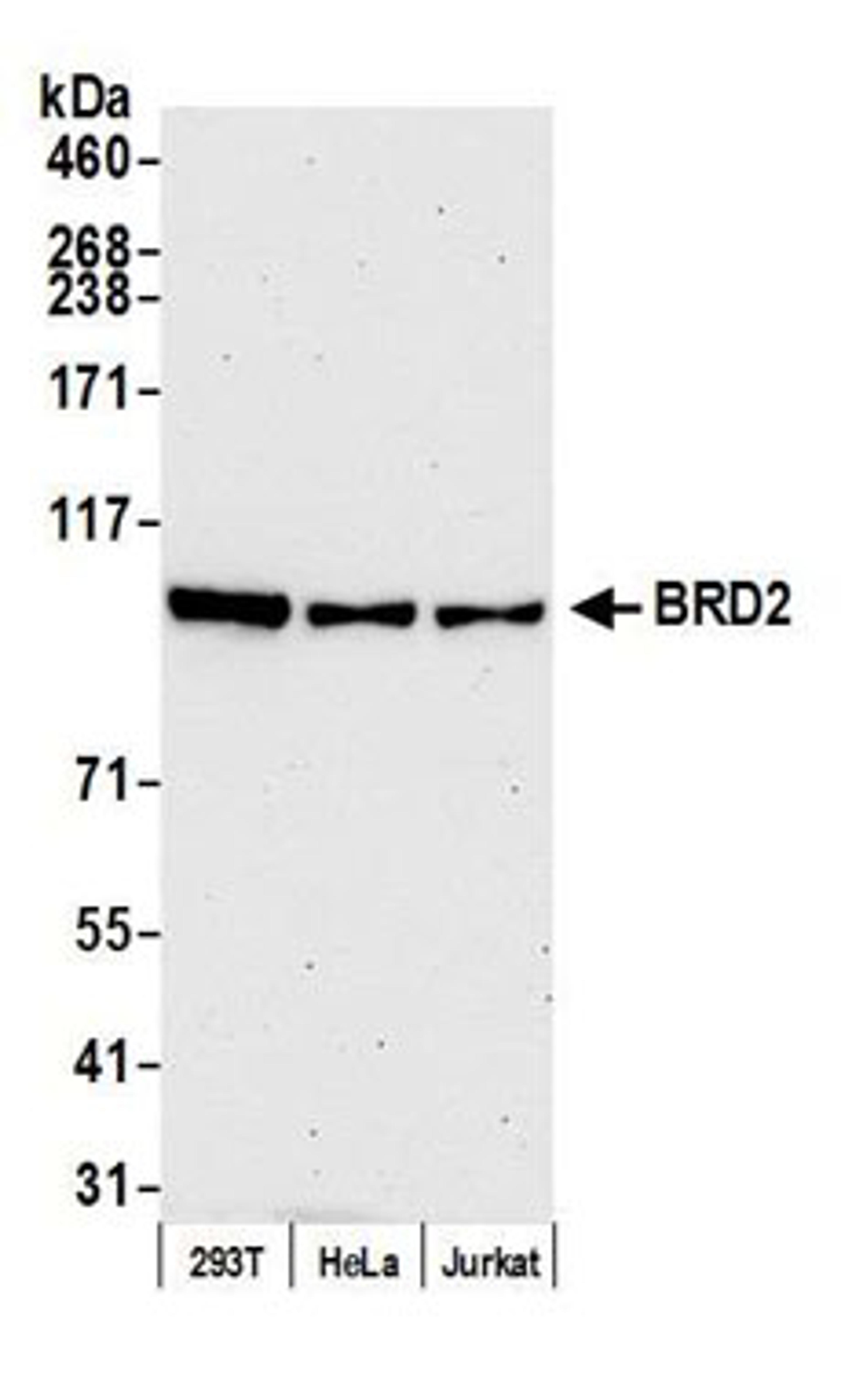 Detection of human BRD2 by western blot.