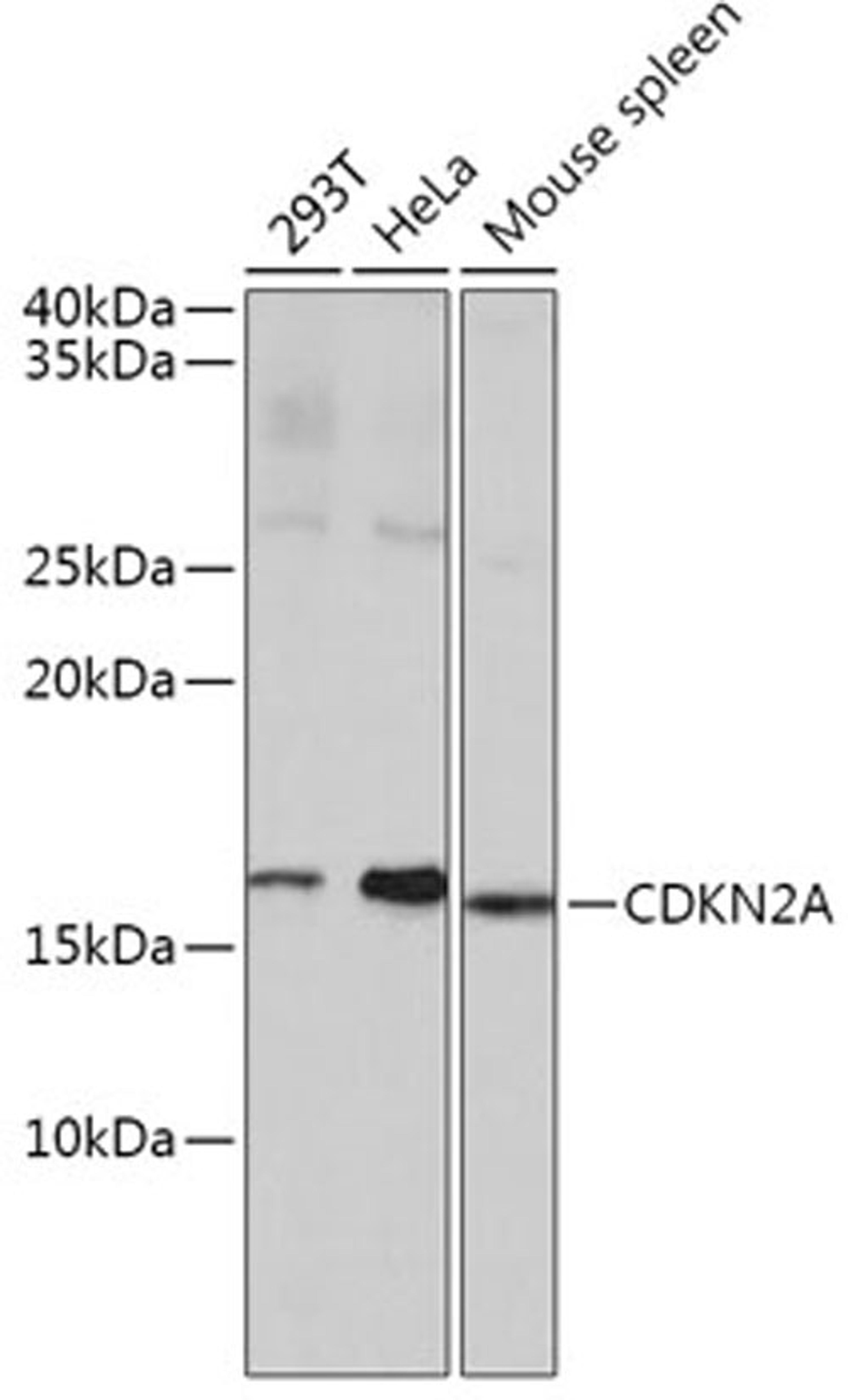 Western blot - CDKN2A antibody (A11337)