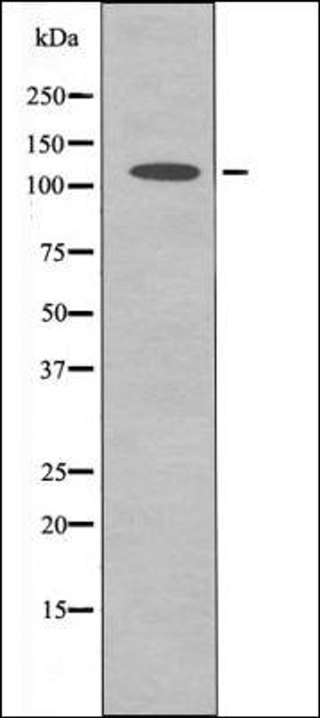 Western blot analysis of HuvEc whole cell lysates using ERK5 -Phospho-Thr218+Tyr220- antibody