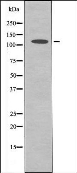 Western blot analysis of HuvEc whole cell lysates using ERK5 -Phospho-Thr218+Tyr220- antibody