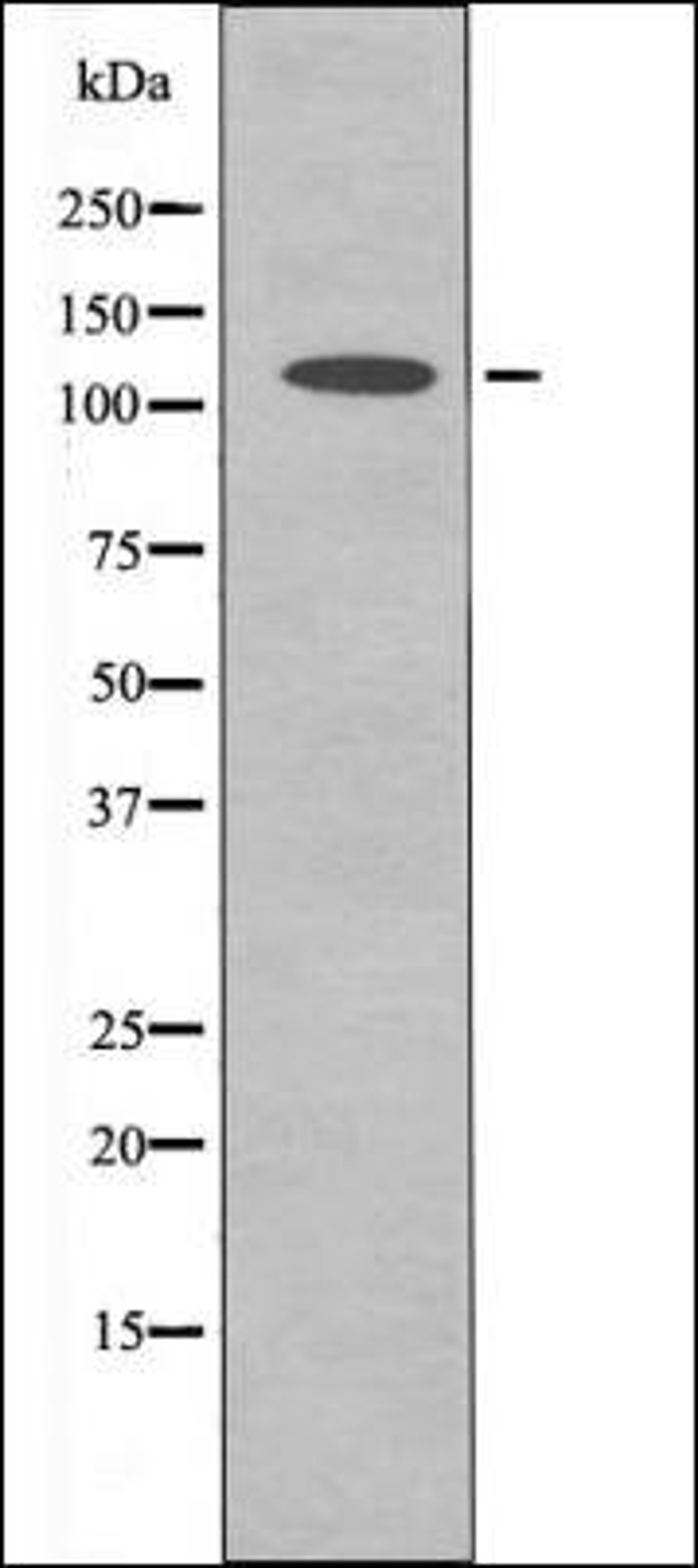 Western blot analysis of HuvEc whole cell lysates using ERK5 -Phospho-Thr218+Tyr220- antibody