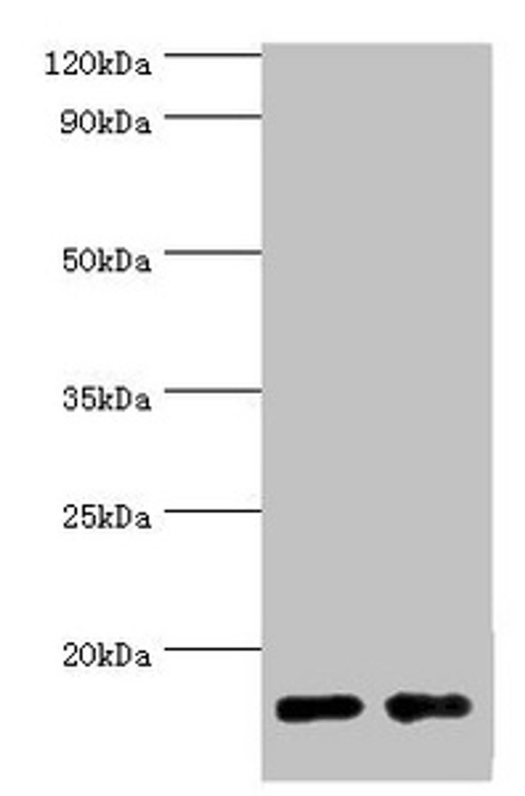 Western blot. All lanes: Gastrotropin antibody at 8ug/ml. Lane 1: Mouse small intestine tissue. Lane 2: Rat small intestine tissue. Secondary. Goat polyclonal to rabbit IgG at 1/10000 dilution. Predicted band size: 15, 20 kDa. Observed band size: 15 kDa. 