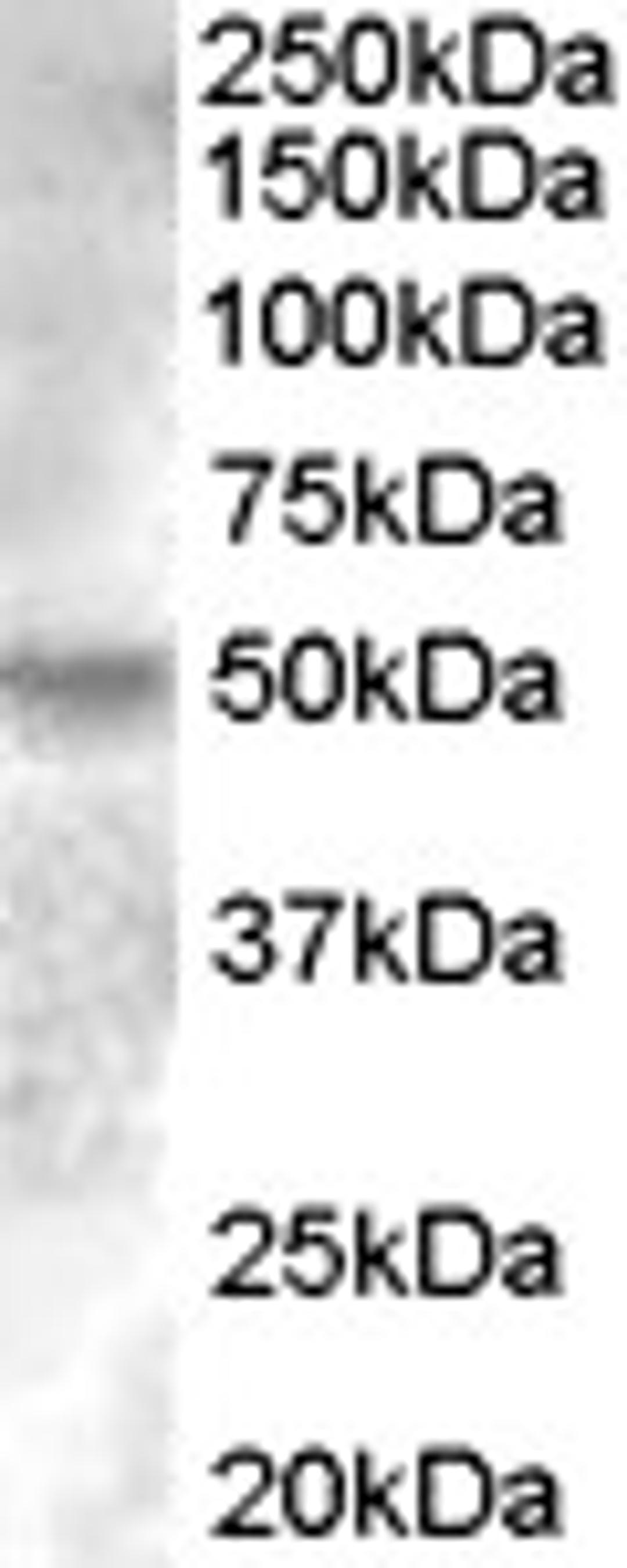 46-655 (0.2ug/ml) staining of Human Breast lysate (35ug protein in RIPA buffer). Primary incubation was 1 hour. Detected by chemiluminescence.