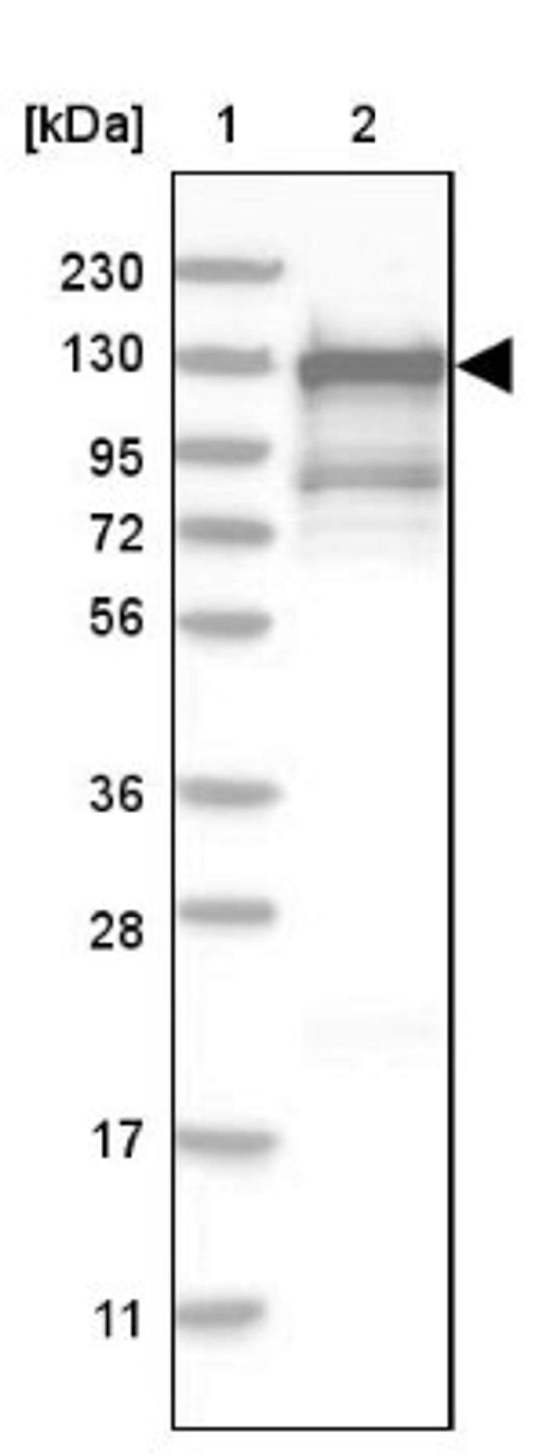 Western Blot: TFII-I Antibody [NBP1-90010] - Lane 1: Marker [kDa] 230, 130, 95, 72, 56, 36, 28, 17, 11<br/>Lane 2: Human cell line RT-4