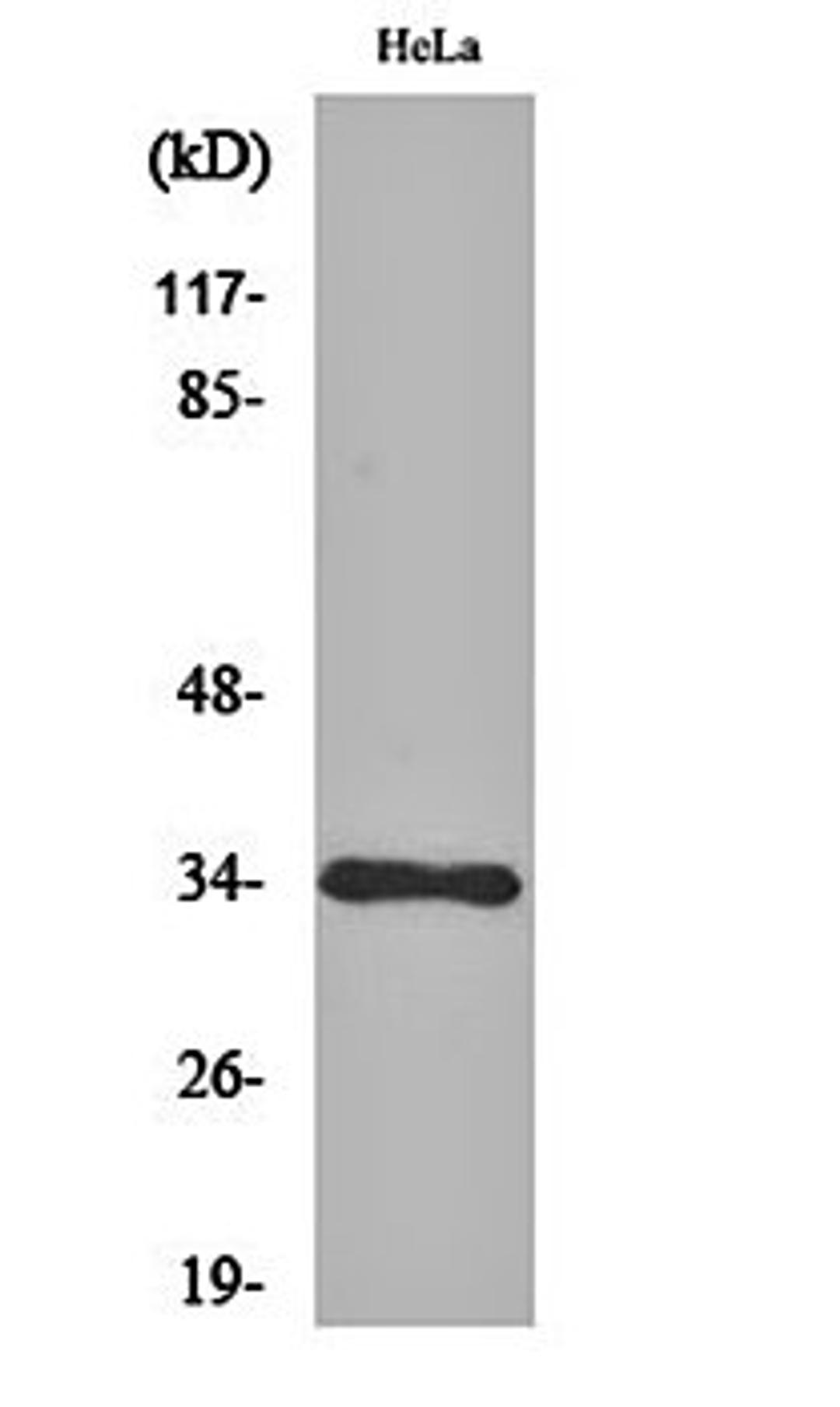 Western blot analysis of Hela cell lysates using Cdk1/2/3 antibody