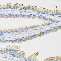 Immunohistochemistry  - LEP antibody (A5673)