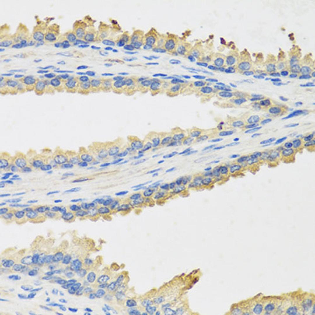 Immunohistochemistry - LEP antibody (A5673)