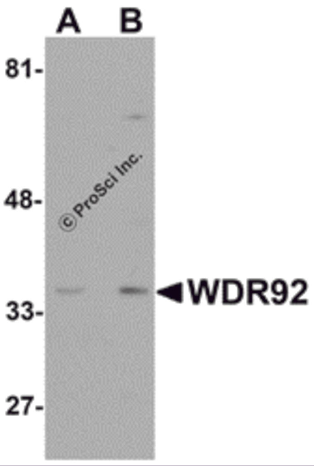 Western blot analysis of WDR92 in human kidney tissue lysate with WDR92 antibody at (A) 1 and (B) 2 &#956;g/mL.