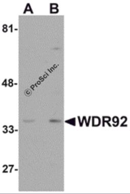 Western blot analysis of WDR92 in human kidney tissue lysate with WDR92 antibody at (A) 1 and (B) 2 μg/mL.