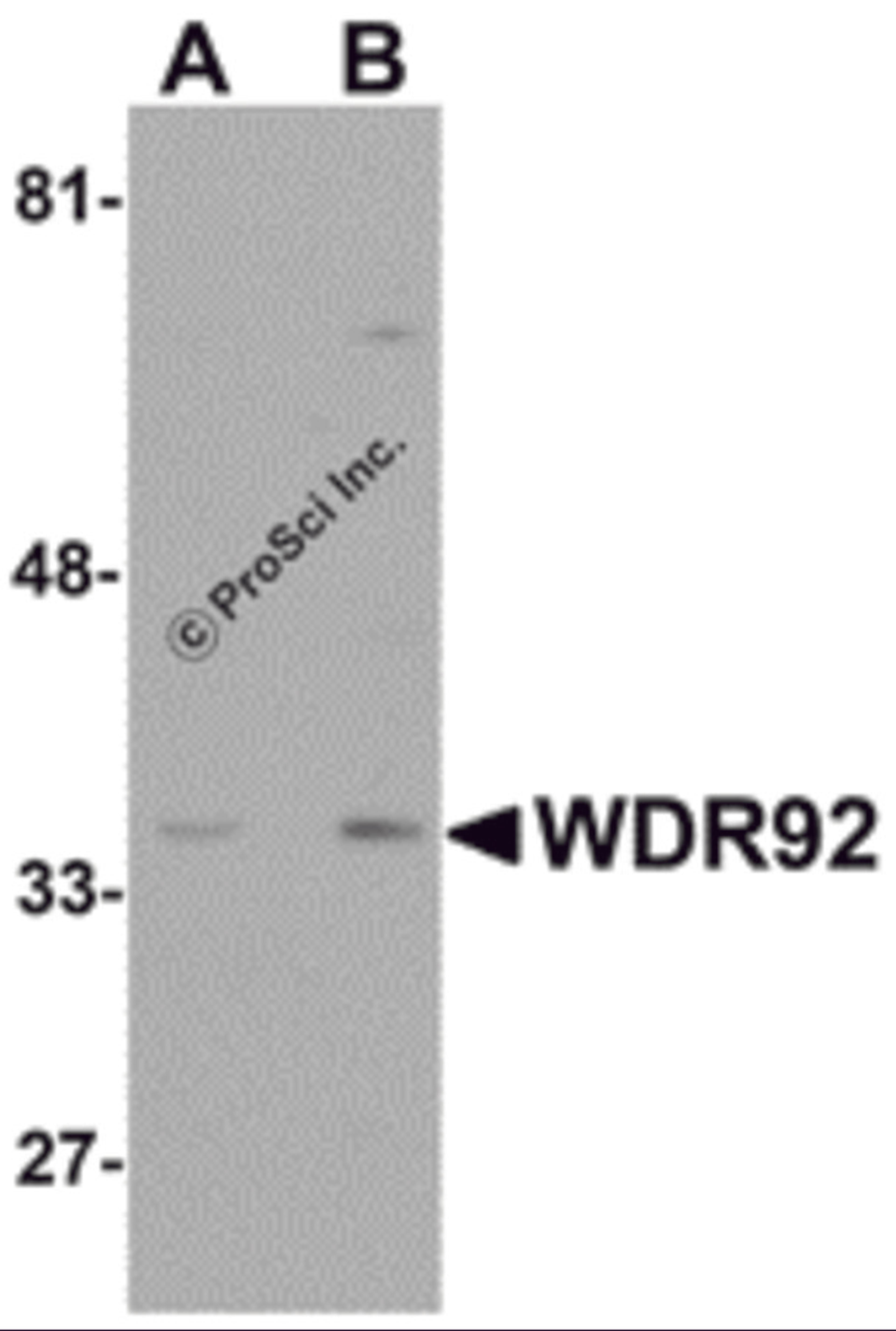 Western blot analysis of WDR92 in human kidney tissue lysate with WDR92 antibody at (A) 1 and (B) 2 μg/mL.