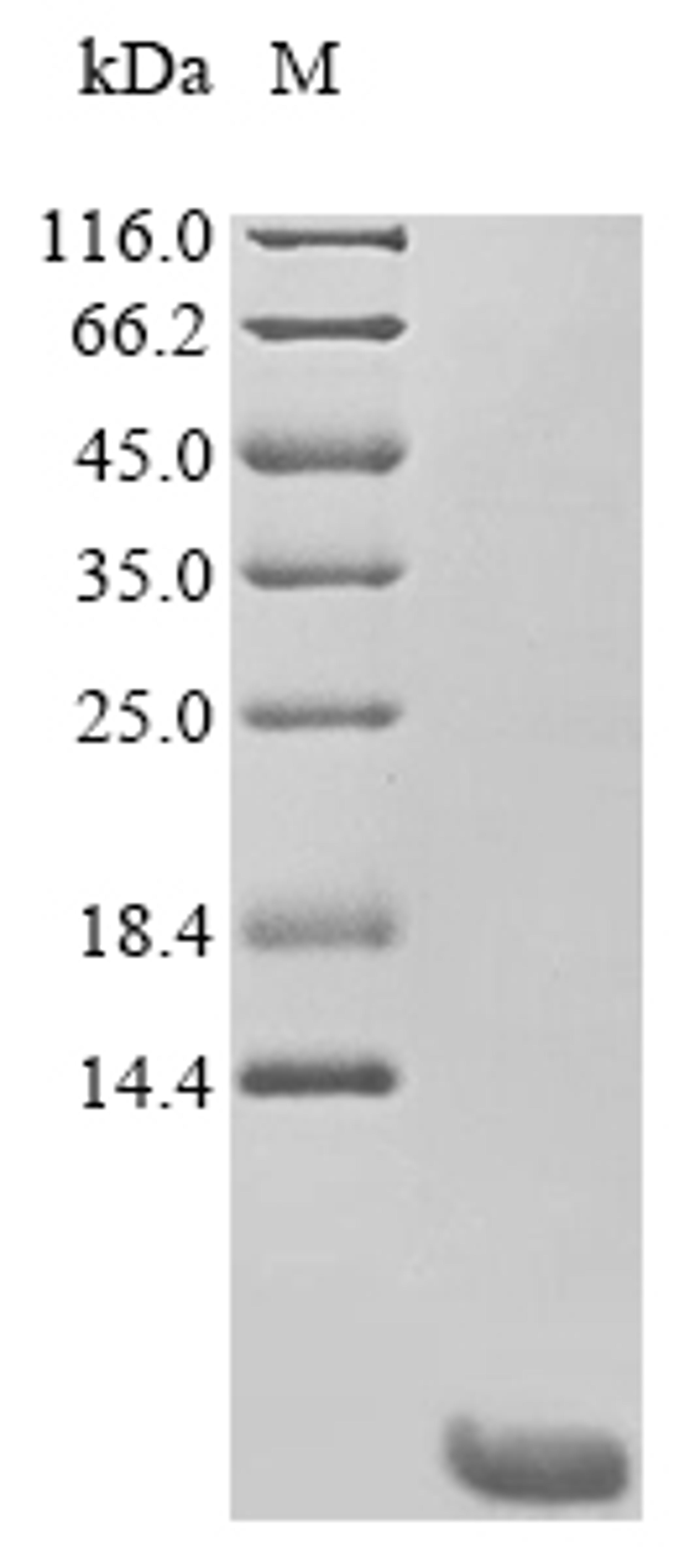 (Tris-Glycine gel) Discontinuous SDS-PAGE (reduced) with 5% enrichment gel and 15% separation gel.