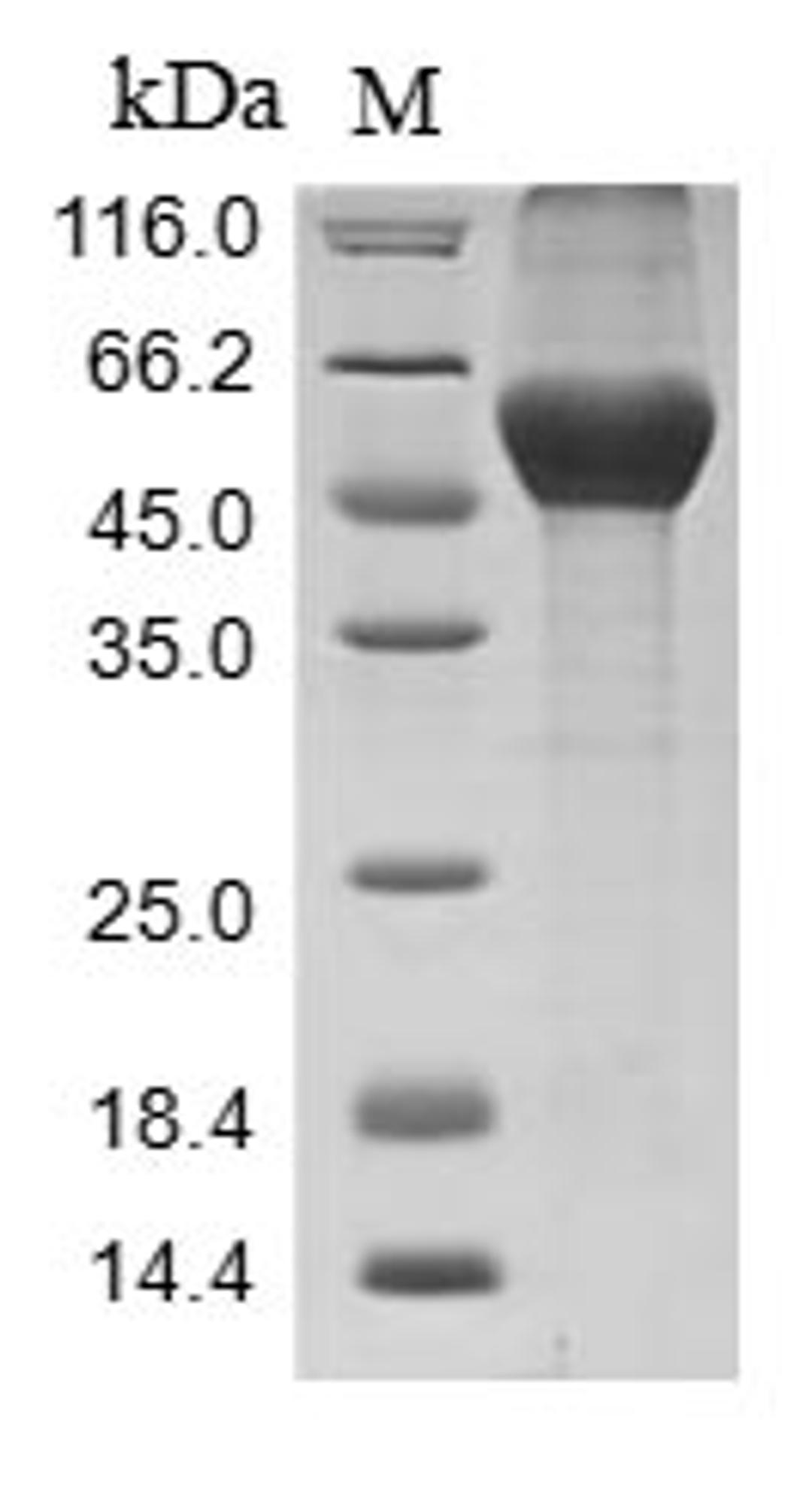 (Tris-Glycine gel) Discontinuous SDS-PAGE (reduced) with 5% enrichment gel and 15% separation gel.