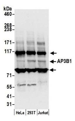 Detection of human AP3B1 by western blot.