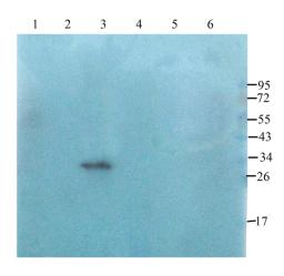 WB analysis of rat kidney (lane 1), mouse uterus (lane 2), mouse heart (lane 3), rat stomach (lane 4), rat thyroid (lane 5), rat lung (lane 6) using Claudin 1 antibody (2.5 ug/ml)