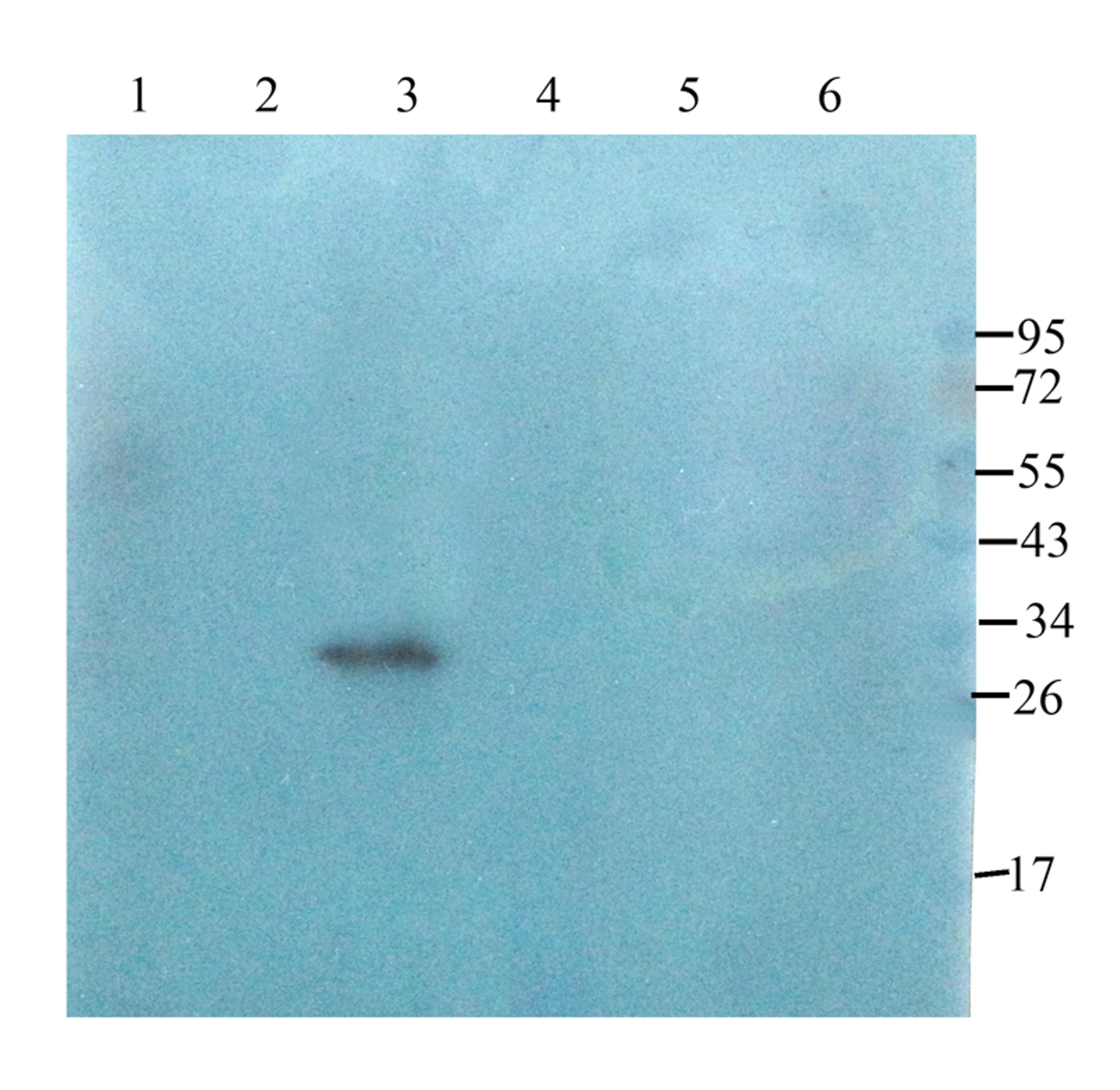 WB analysis of rat kidney (lane 1), mouse uterus (lane 2), mouse heart (lane 3), rat stomach (lane 4), rat thyroid (lane 5), rat lung (lane 6) using Claudin 1 antibody (2.5 ug/ml)