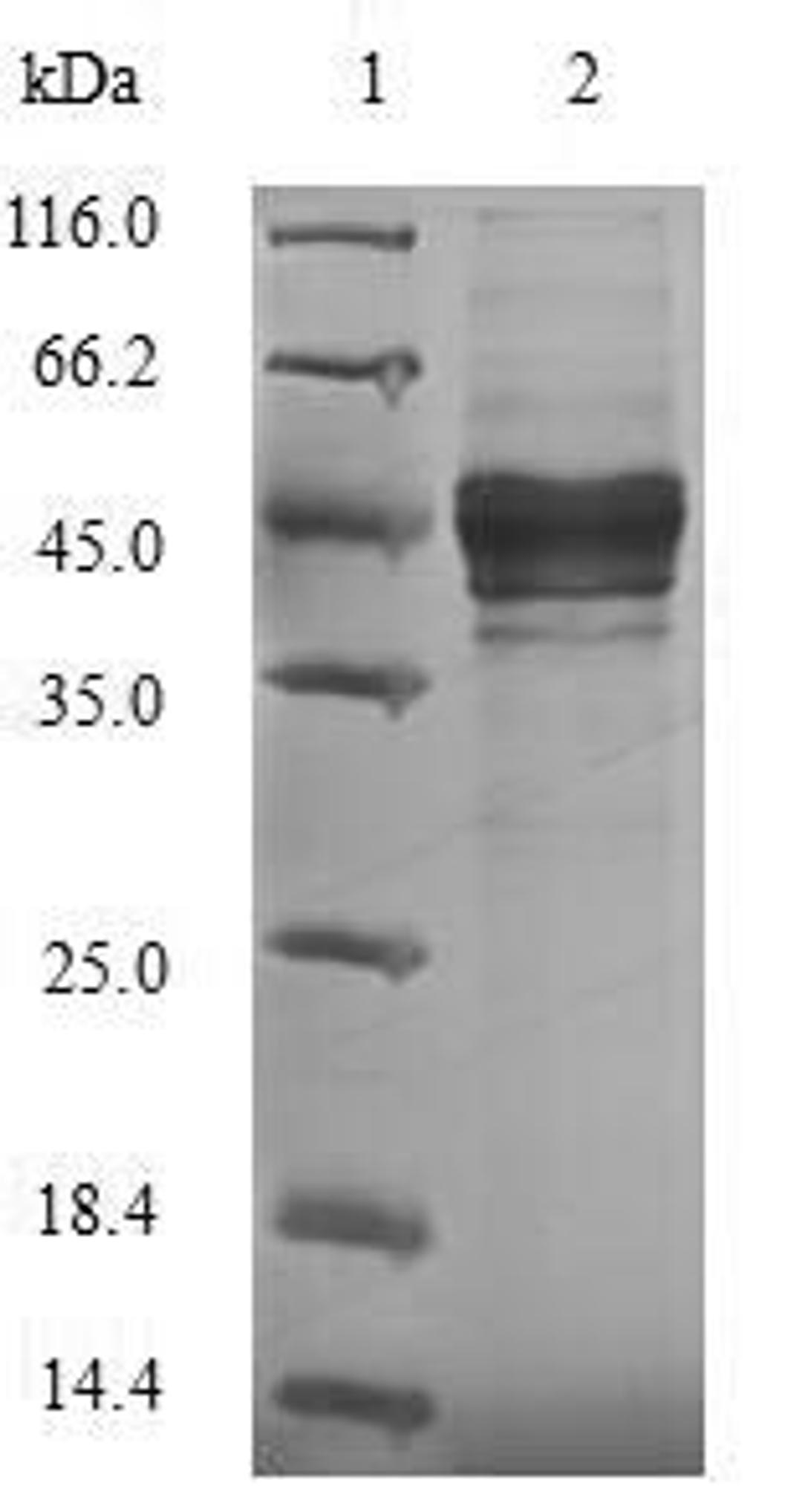 (Tris-Glycine gel) Discontinuous SDS-PAGE (reduced) with 5% enrichment gel and 15% separation gel.