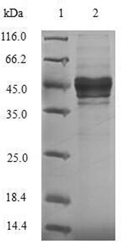 (Tris-Glycine gel) Discontinuous SDS-PAGE (reduced) with 5% enrichment gel and 15% separation gel.