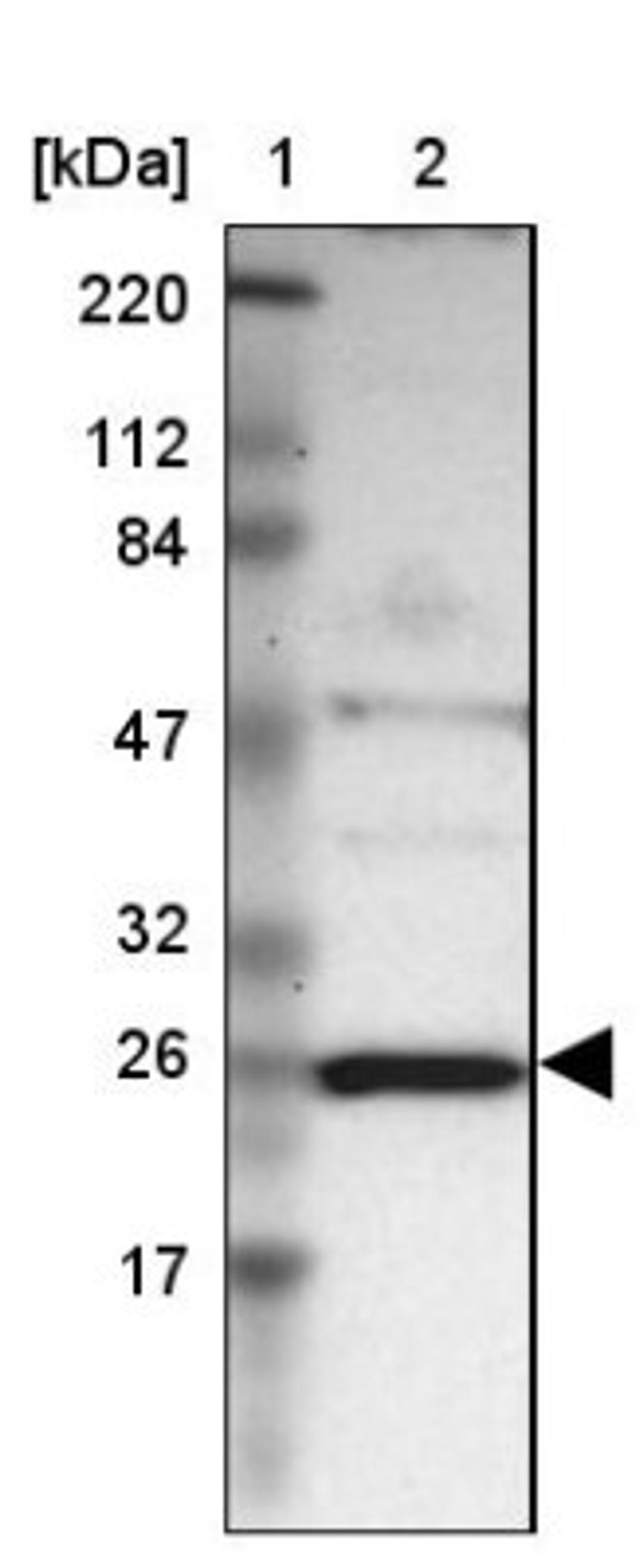 Western Blot: NDUFV2 Antibody [NBP1-84475] - Lane 1: Marker [kDa] 220, 112, 84, 47, 32, 26, 17<br/>Lane 2: Human cell line RT-4