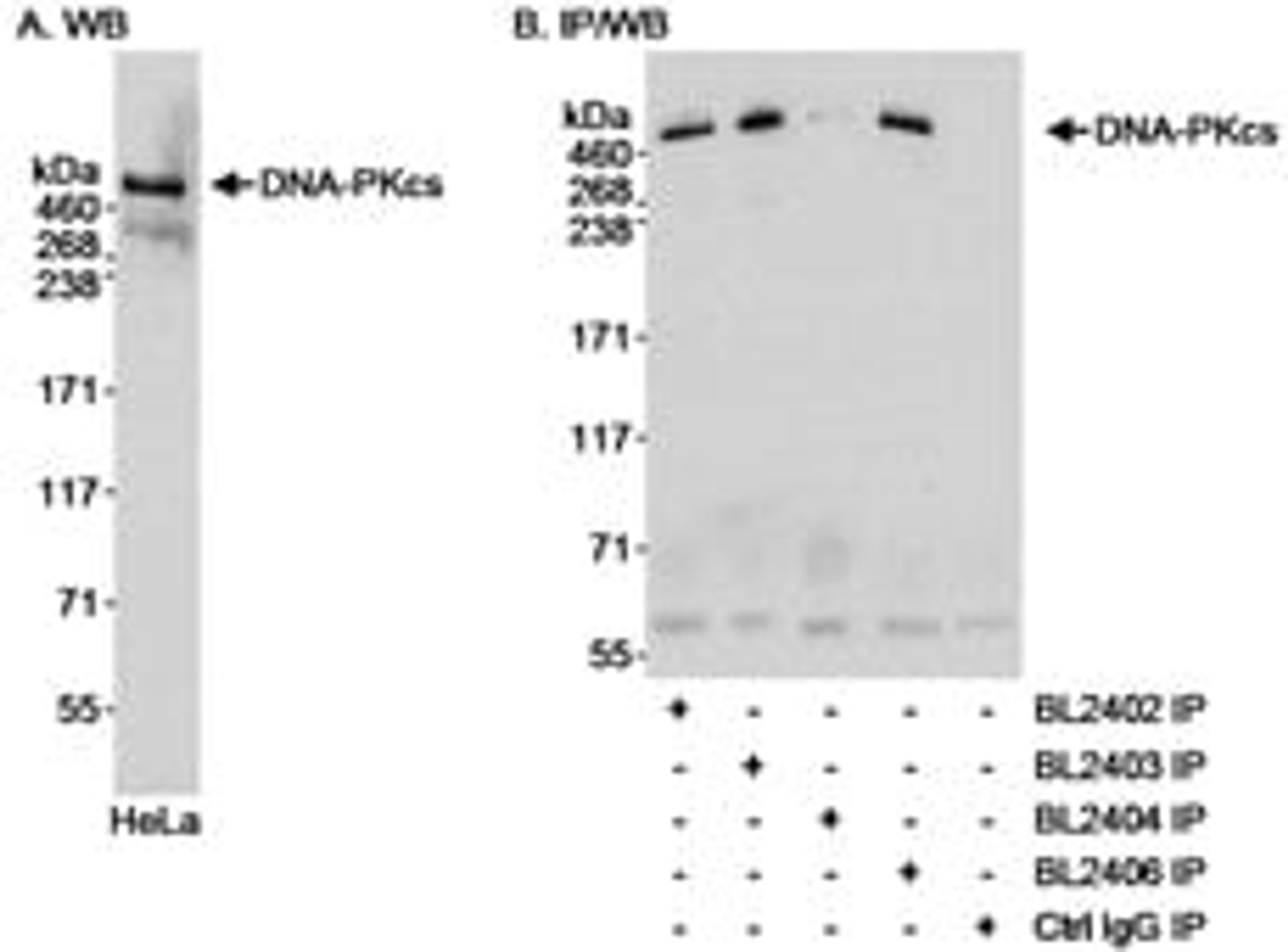 Detection of human DNA-PKcs by western blot and immunoprecipitation.