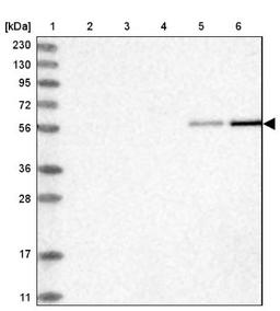 Western Blot: RMND1 Antibody [NBP1-90033] - Lane 1: Marker [kDa] 230, 130, 95, 72, 56, 36, 28, 17, 11<br/>Lane 2: Human cell line RT-4<br/>Lane 3: Human cell line U-251MG sp<br/>Lane 4: Human plasma (IgG/HSA depleted)<br/>Lane 5: Human liver tissue<br/>Lane 6: Human tonsil tissue