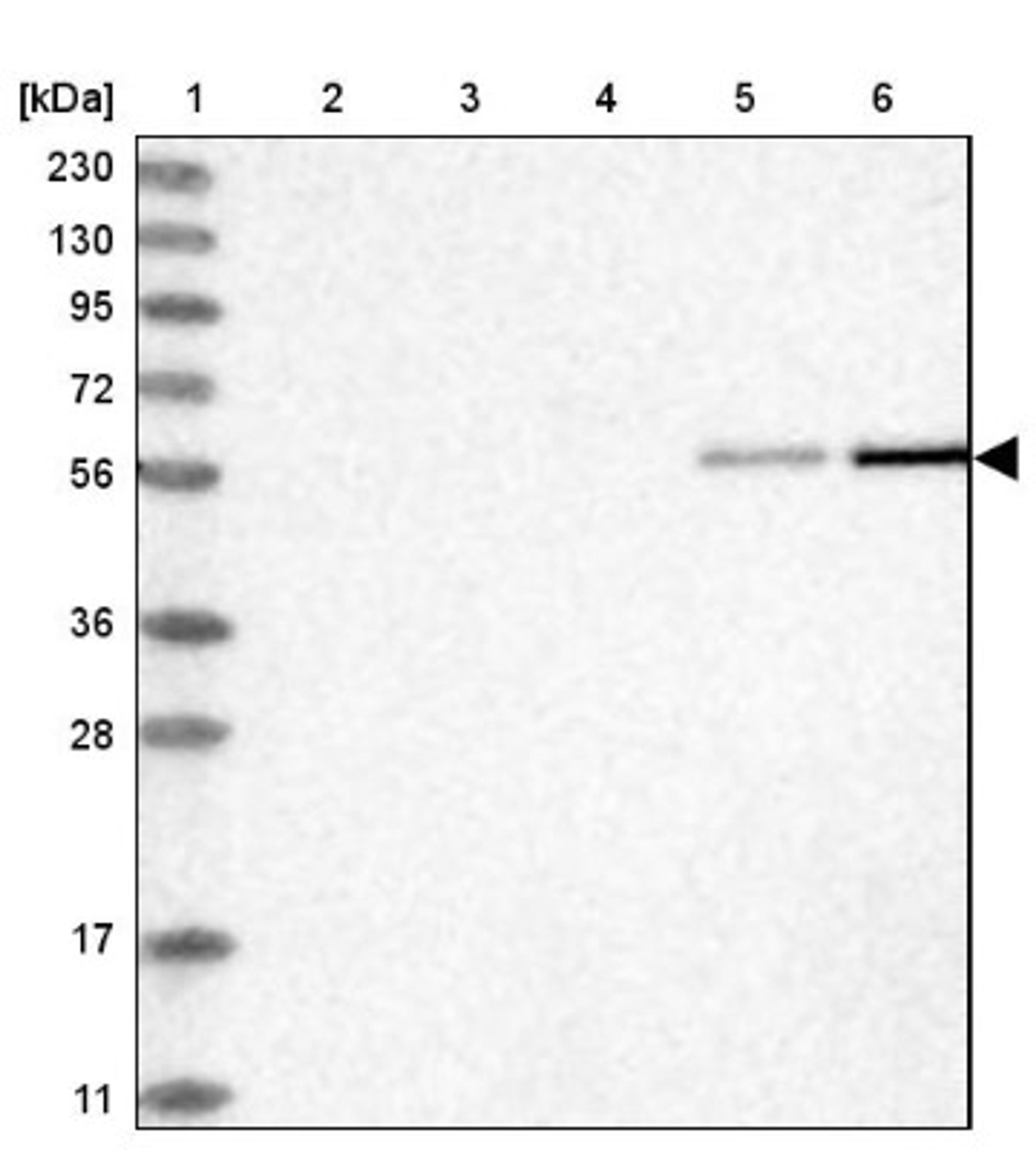 Western Blot: RMND1 Antibody [NBP1-90033] - Lane 1: Marker [kDa] 230, 130, 95, 72, 56, 36, 28, 17, 11<br/>Lane 2: Human cell line RT-4<br/>Lane 3: Human cell line U-251MG sp<br/>Lane 4: Human plasma (IgG/HSA depleted)<br/>Lane 5: Human liver tissue<br/>Lane 6: Human tonsil tissue