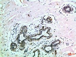 Immunohistochemical analysis of paraffin-embedded Human-breast, antibody was diluted at 1:100