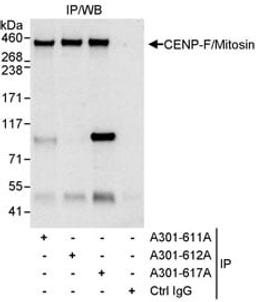 Detection of human CENP-F/Mitosin by western blot of immunoprecipitates.