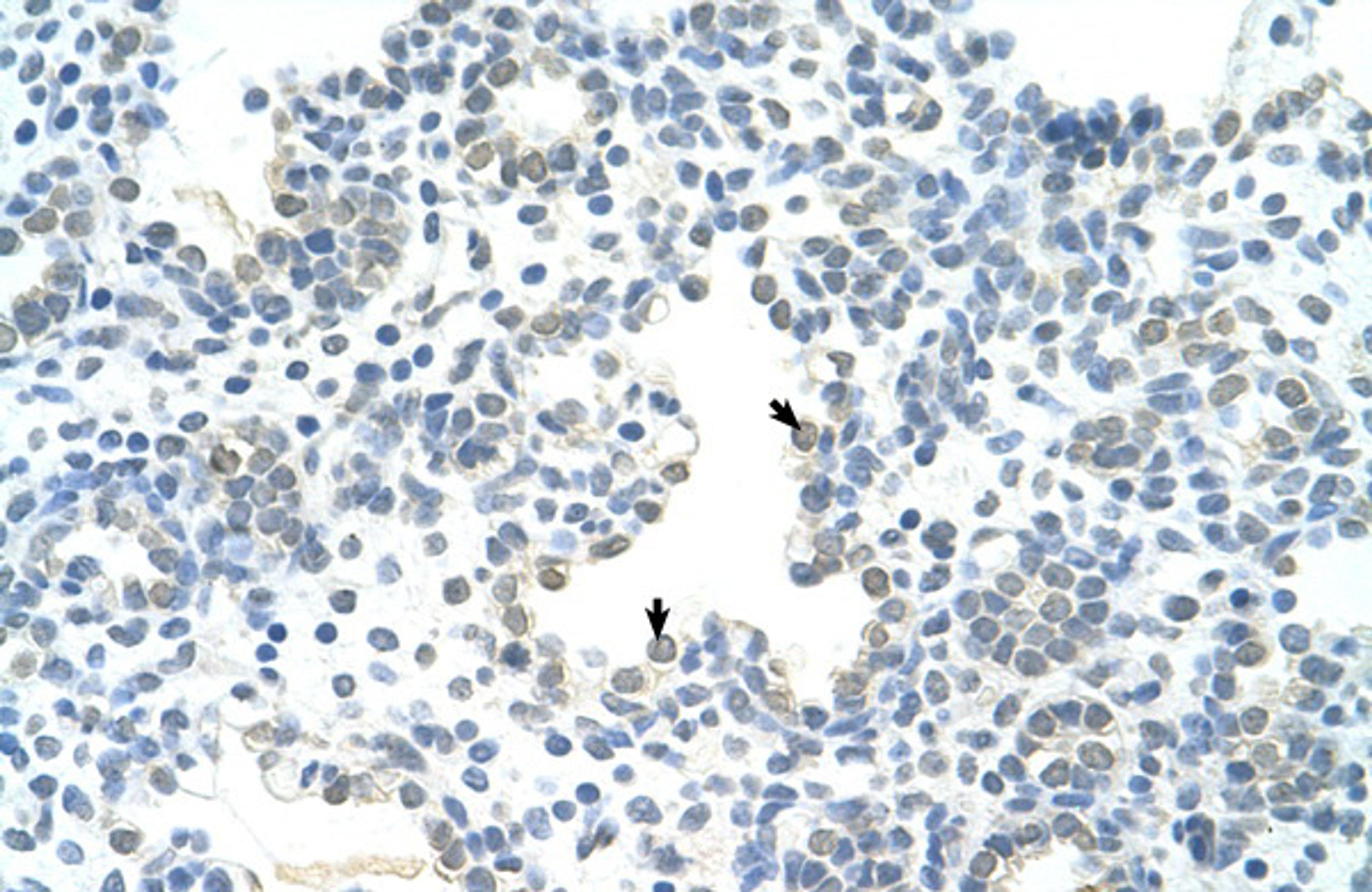 Antibody used in IHC on Human Lung.