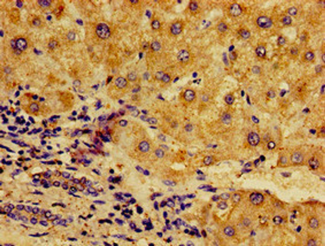 Immunohistochemistry of paraffin-embedded human liver tissue using CSB-PA10449A0Rb at dilution of 1:100