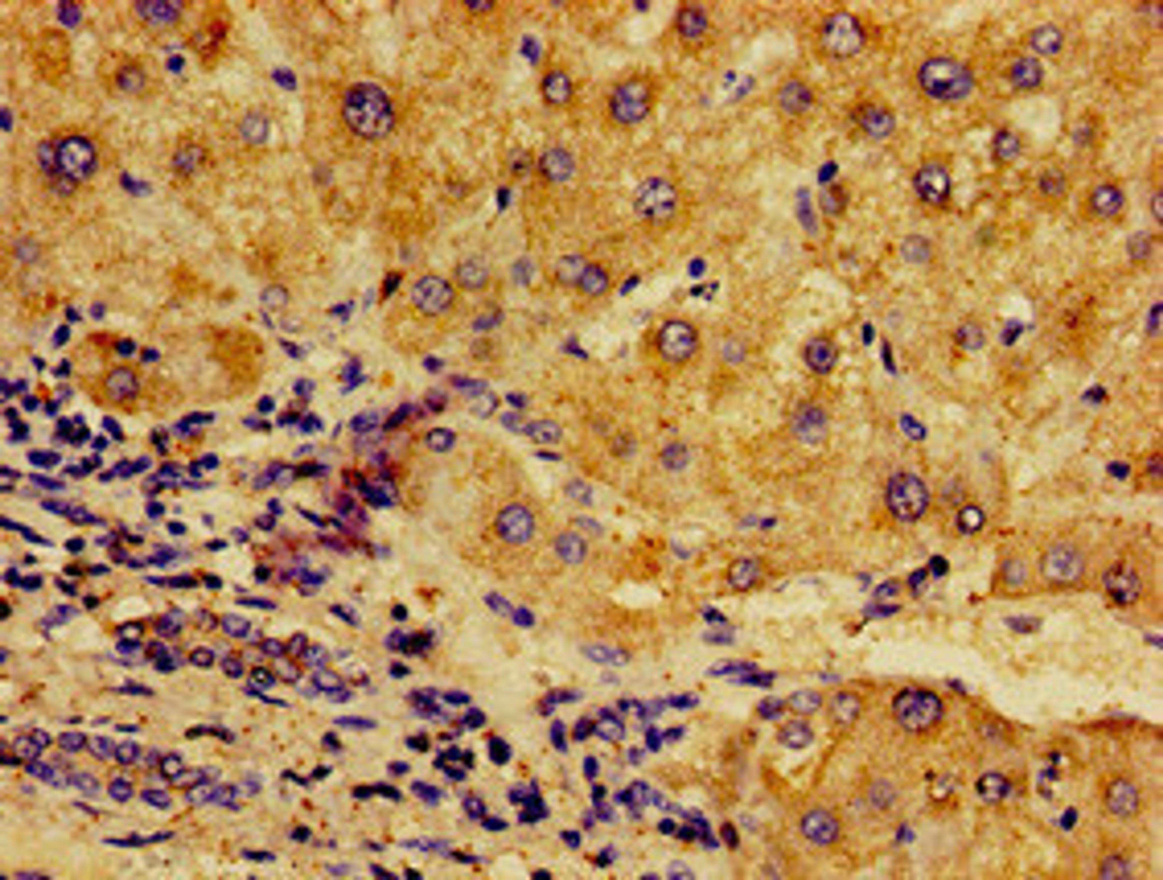 Immunohistochemistry of paraffin-embedded human liver tissue using CSB-PA10449A0Rb at dilution of 1:100