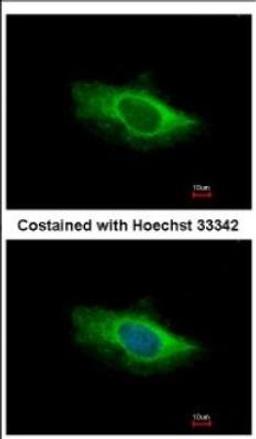 Immunocytochemistry/Immunofluorescence: Glutamate Dehydrogenase 2/GLUD2 Antibody [NBP2-16678] - Analysis of methanol-fixed HeLa, using antibody at 1:500 dilution.