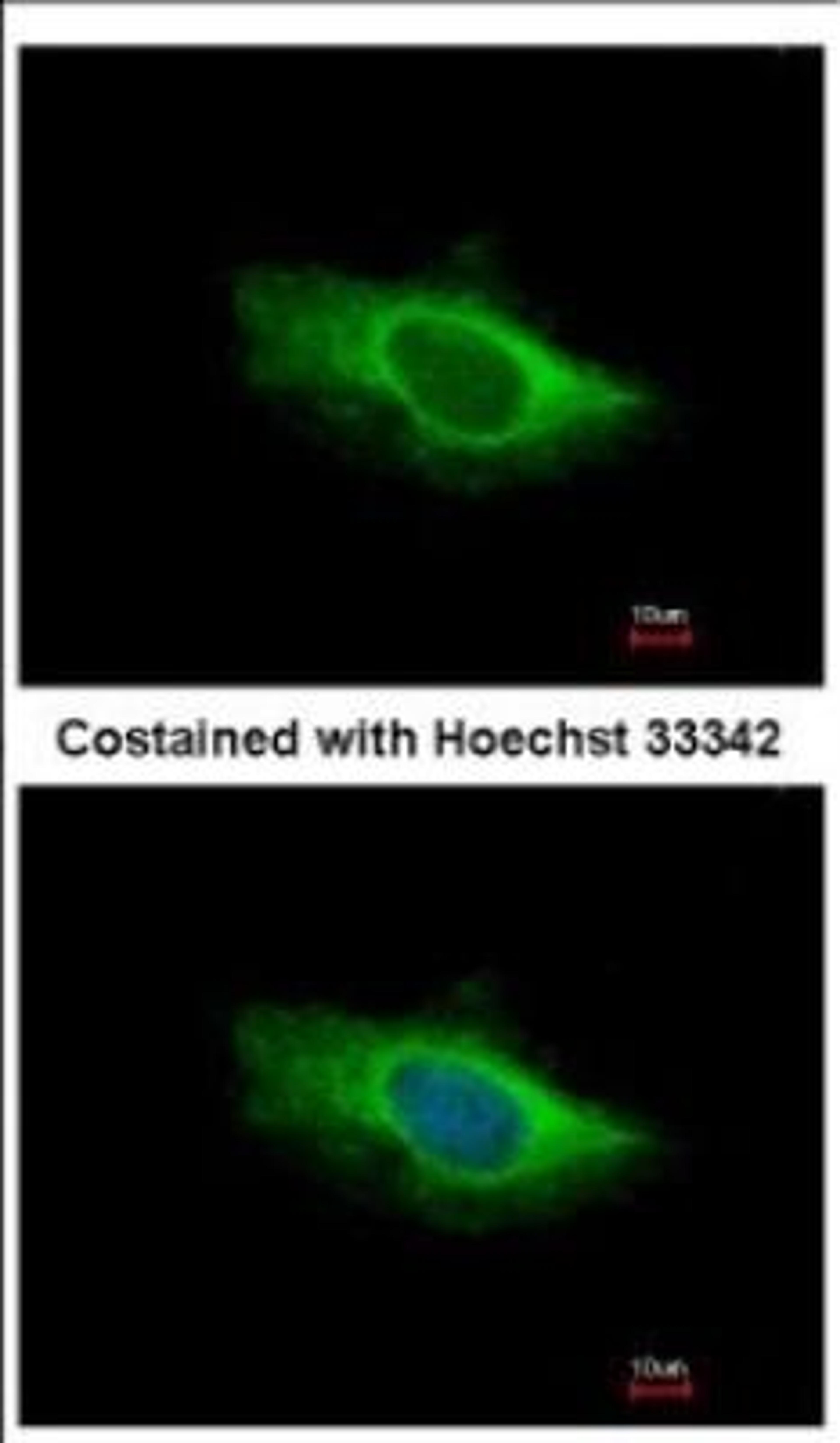 Immunocytochemistry/Immunofluorescence: Glutamate Dehydrogenase 2/GLUD2 Antibody [NBP2-16678] - Analysis of methanol-fixed HeLa, using antibody at 1:500 dilution.