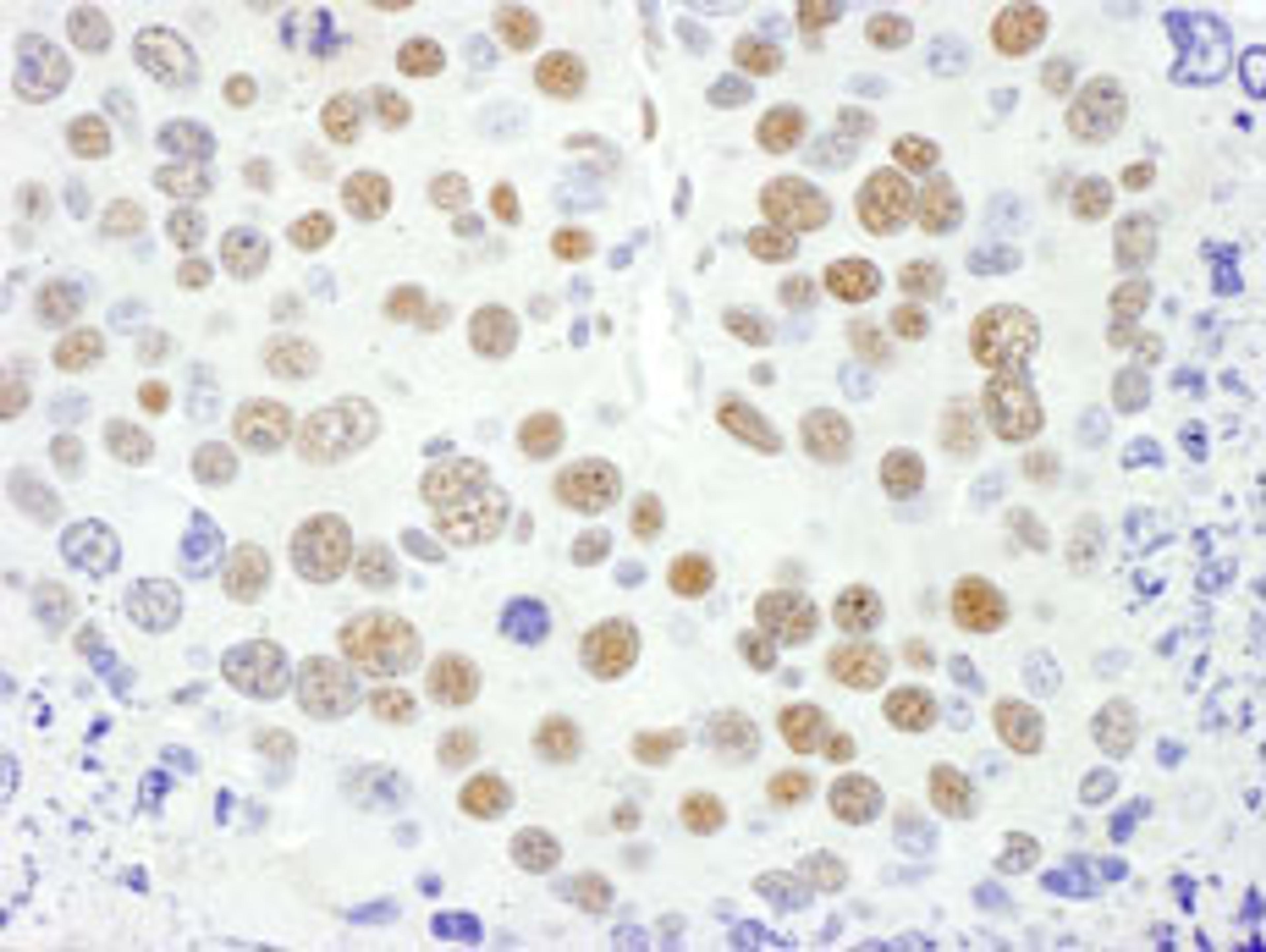 Detection of mouse MEF2D by immunohistochemistry.