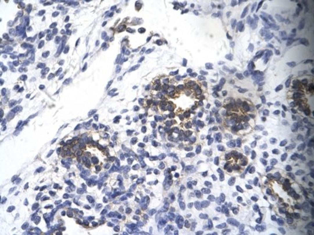 Immunohistochemistry: RPS16 Antibody [NBP1-80025] - Human alveolar cell Cellular data: Epithelial cells of renal tubule Antibody Concentration: 4.0-8.0 ug/ml Magnification: 400X.