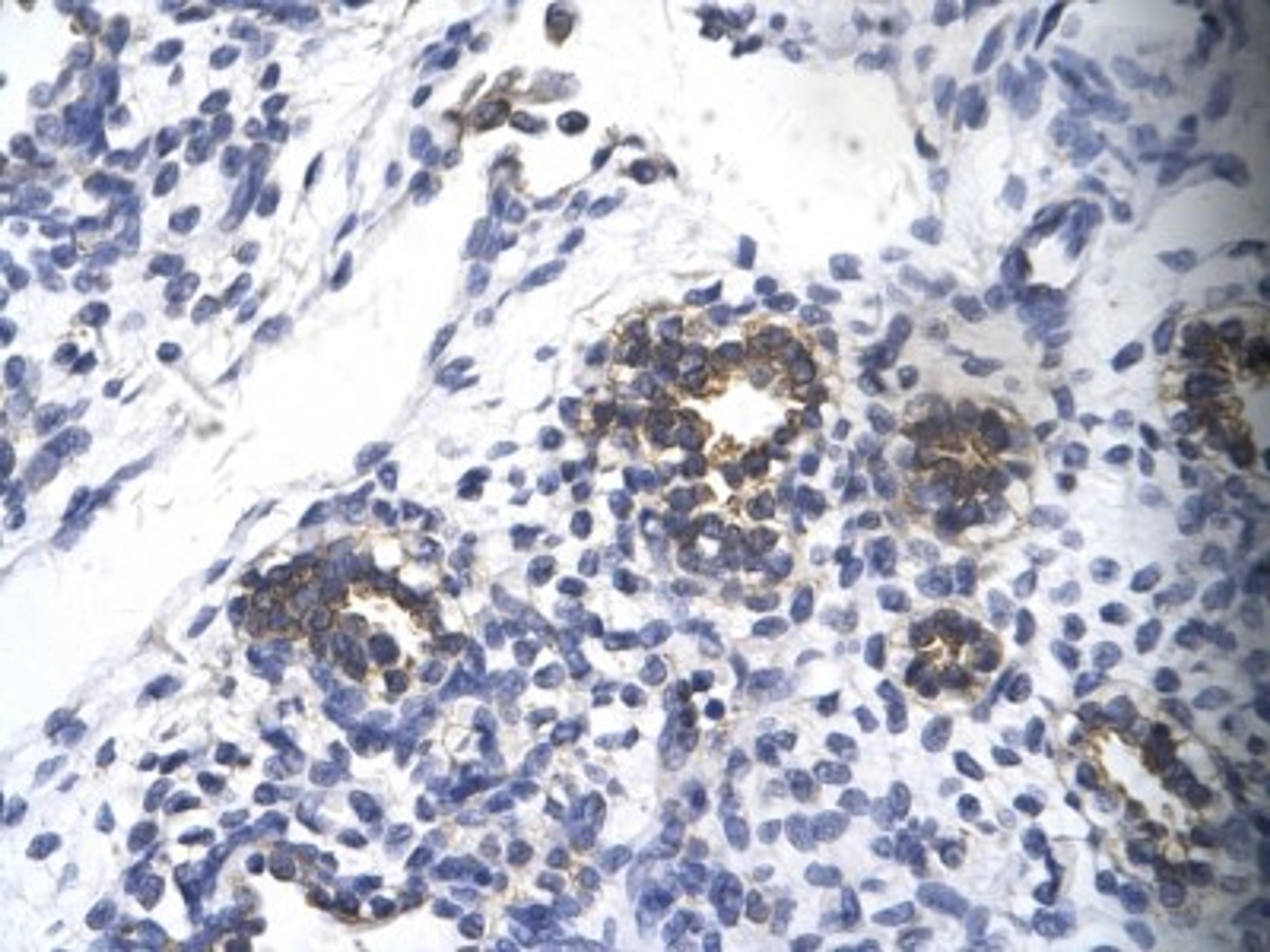 Immunohistochemistry: RPS16 Antibody [NBP1-80025] - Human alveolar cell Cellular data: Epithelial cells of renal tubule Antibody Concentration: 4.0-8.0 ug/ml Magnification: 400X.