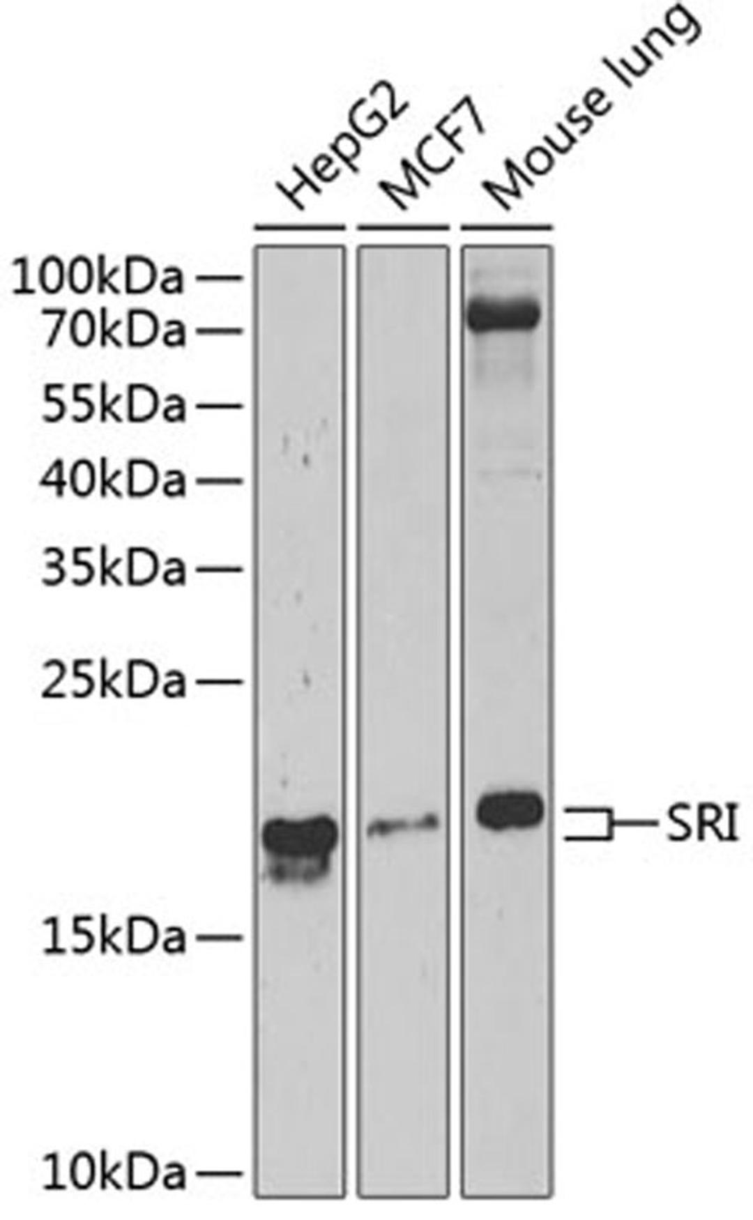 Western blot - SRI Antibody (A6751)