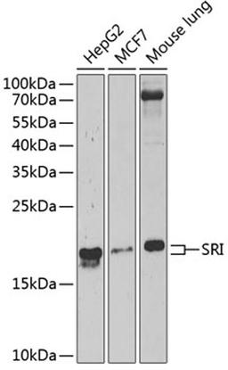 Western blot - SRI Antibody (A6751)