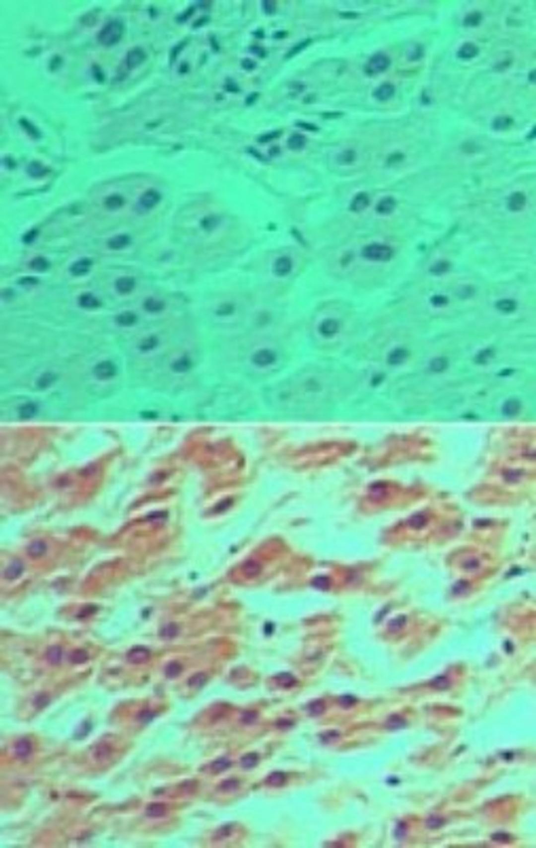 Immunohistochemistry-Paraffin: DRAM Antibody [NBP2-24758] - Analysis of DRAM in formalin-fixed, paraffin-embedded human liver tissue using an isotype control (top) and this antibody (bottom) at 5 ug/ml.