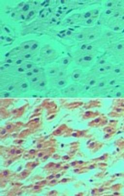 Immunohistochemistry-Paraffin: DRAM Antibody [NBP2-24758] - Analysis of DRAM in formalin-fixed, paraffin-embedded human liver tissue using an isotype control (top) and this antibody (bottom) at 5 ug/ml.