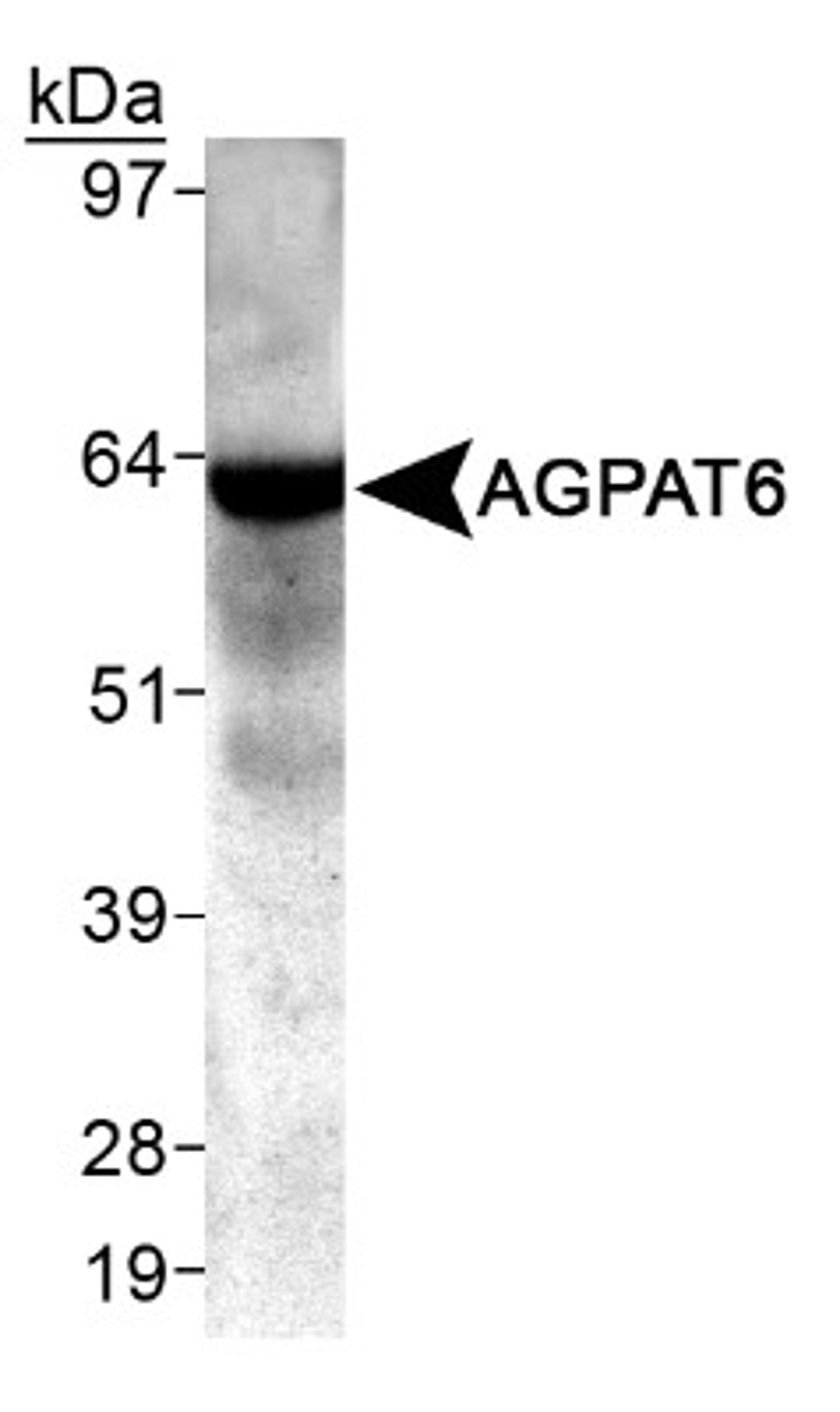 Western Blot: AGPAT6 Antibody [NB100-2390] - Detection of AGPAT6 in mouse skeletal muscle using NB 100-2390.