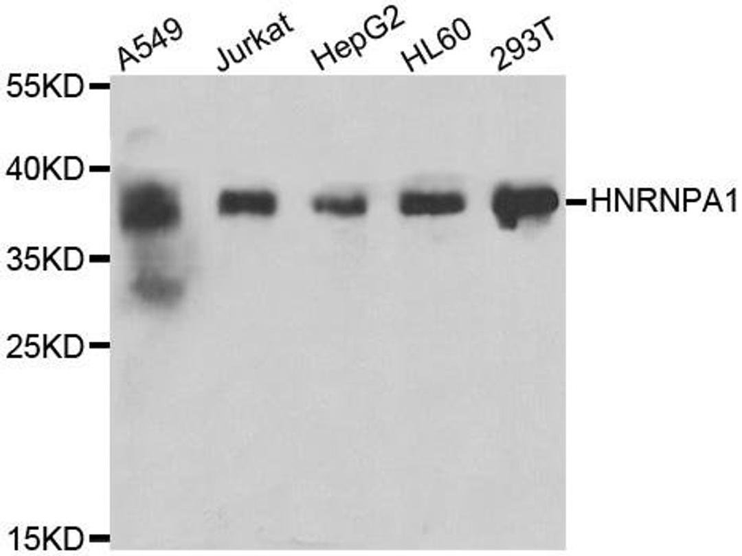 Western blot analysis of extracts of various cell lines using HNRNPA1 antibody