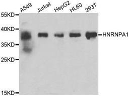 Western blot analysis of extracts of various cell lines using HNRNPA1 antibody