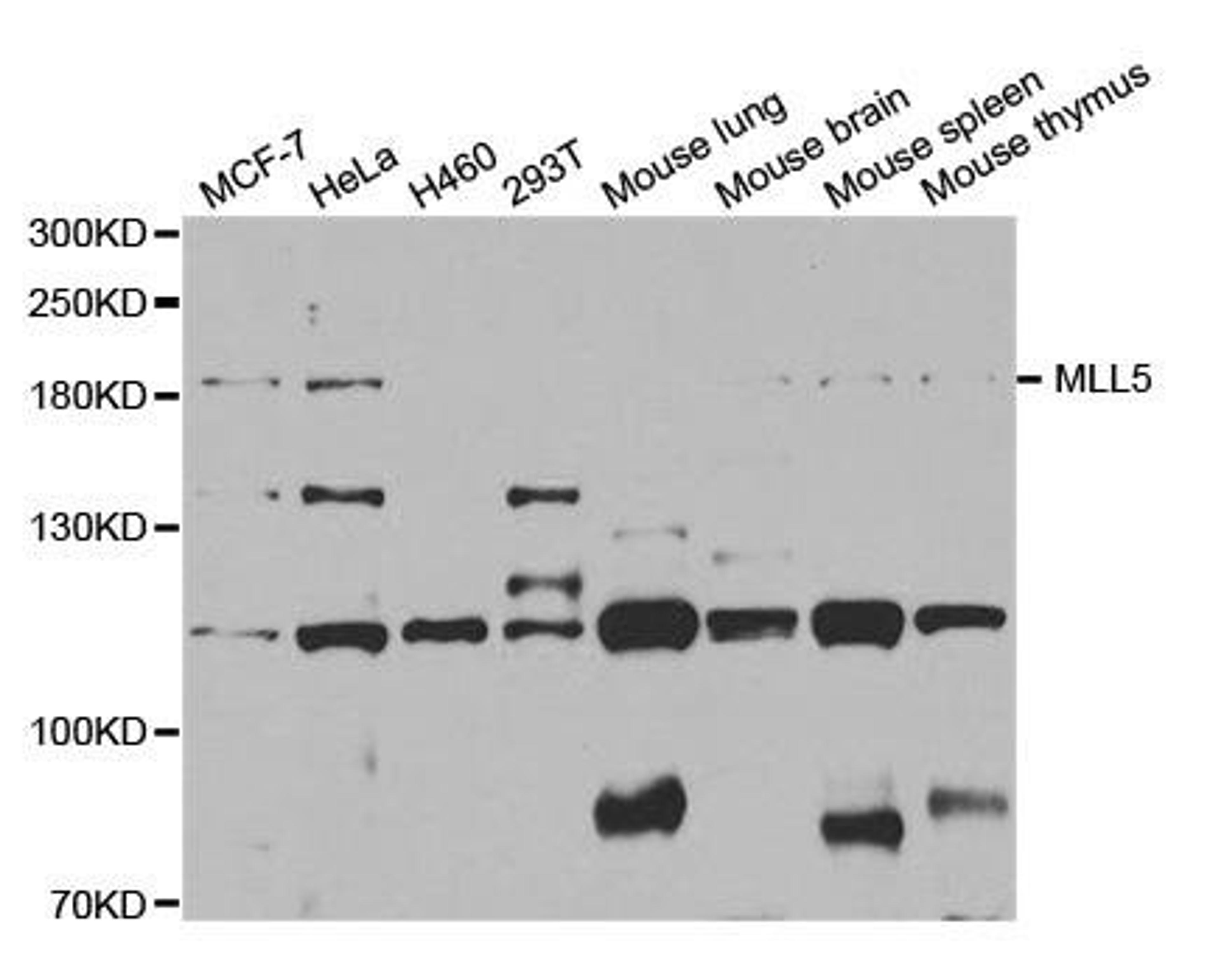 Western blot analysis of extracts of various cells using KMT2E antibody