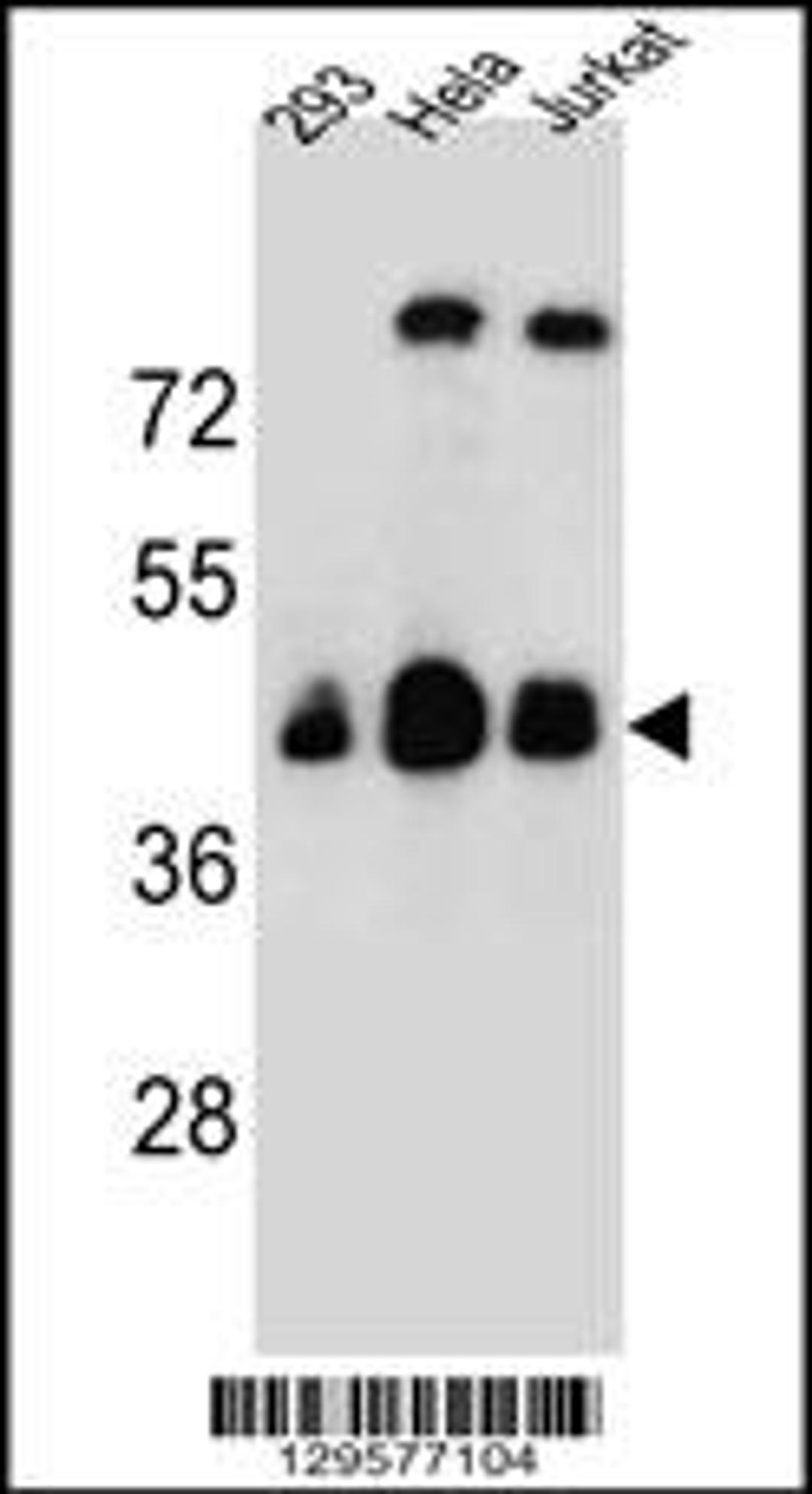 Western blot analysis in 293,Hela,Jurkat cell line lysates (35ug/lane).