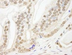 Detection of human Pds5B by immunohistochemistry.