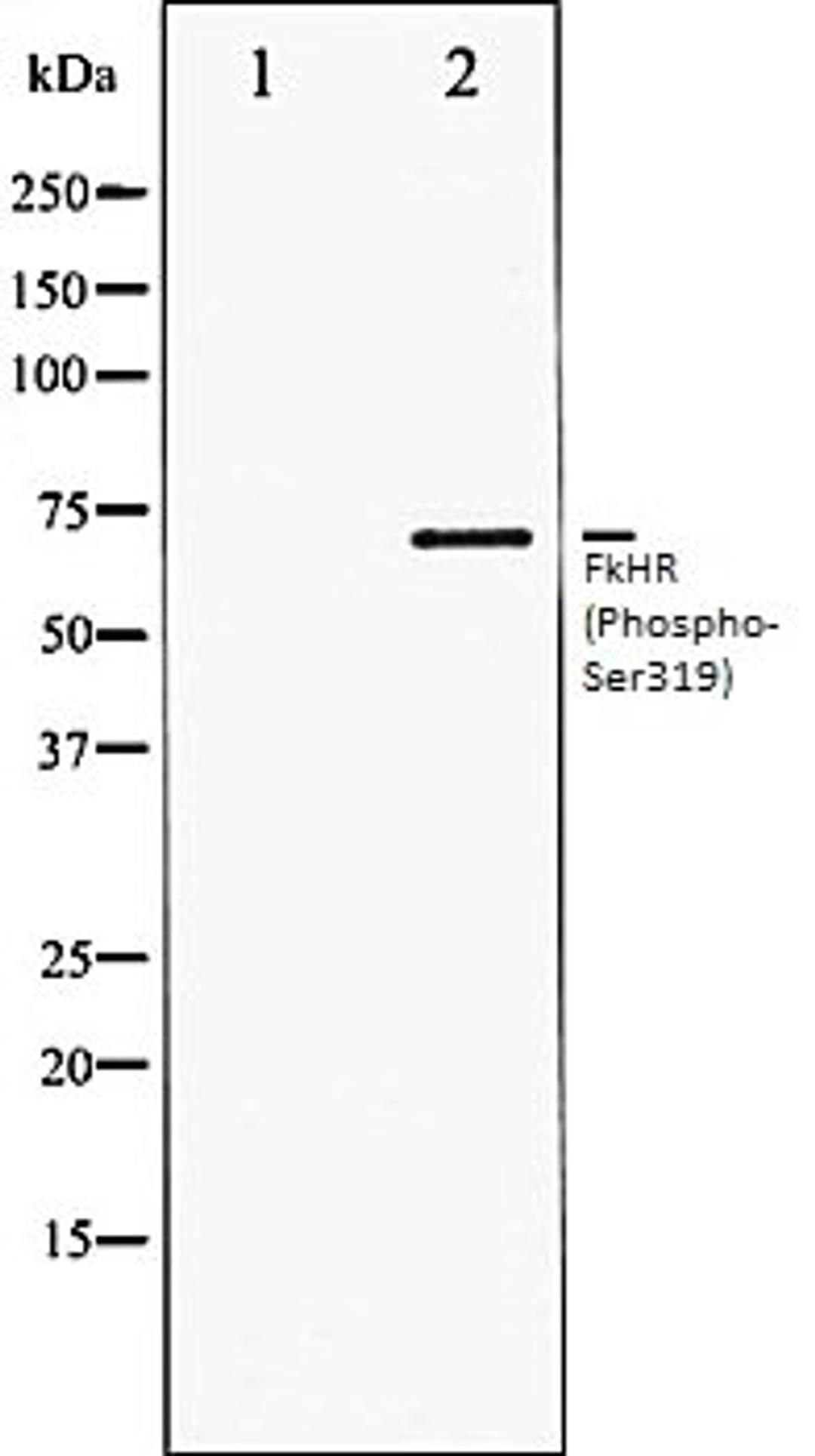 Western blot analysis of HeLa whole cell lysates using FKHR (Phospho-Ser319) antibody, The lane on the left is treated with the antigen-specific peptide.