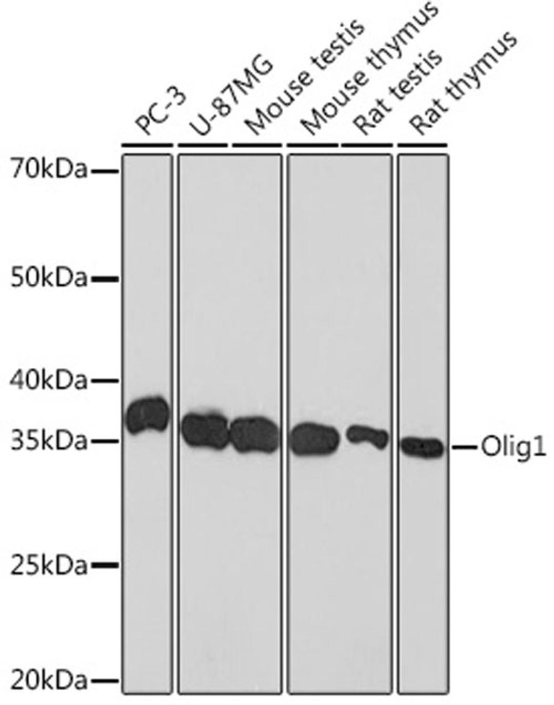 Western blot - Olig1 Rabbit mAb (A0953)