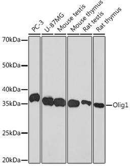 Western blot - Olig1 Rabbit mAb (A0953)