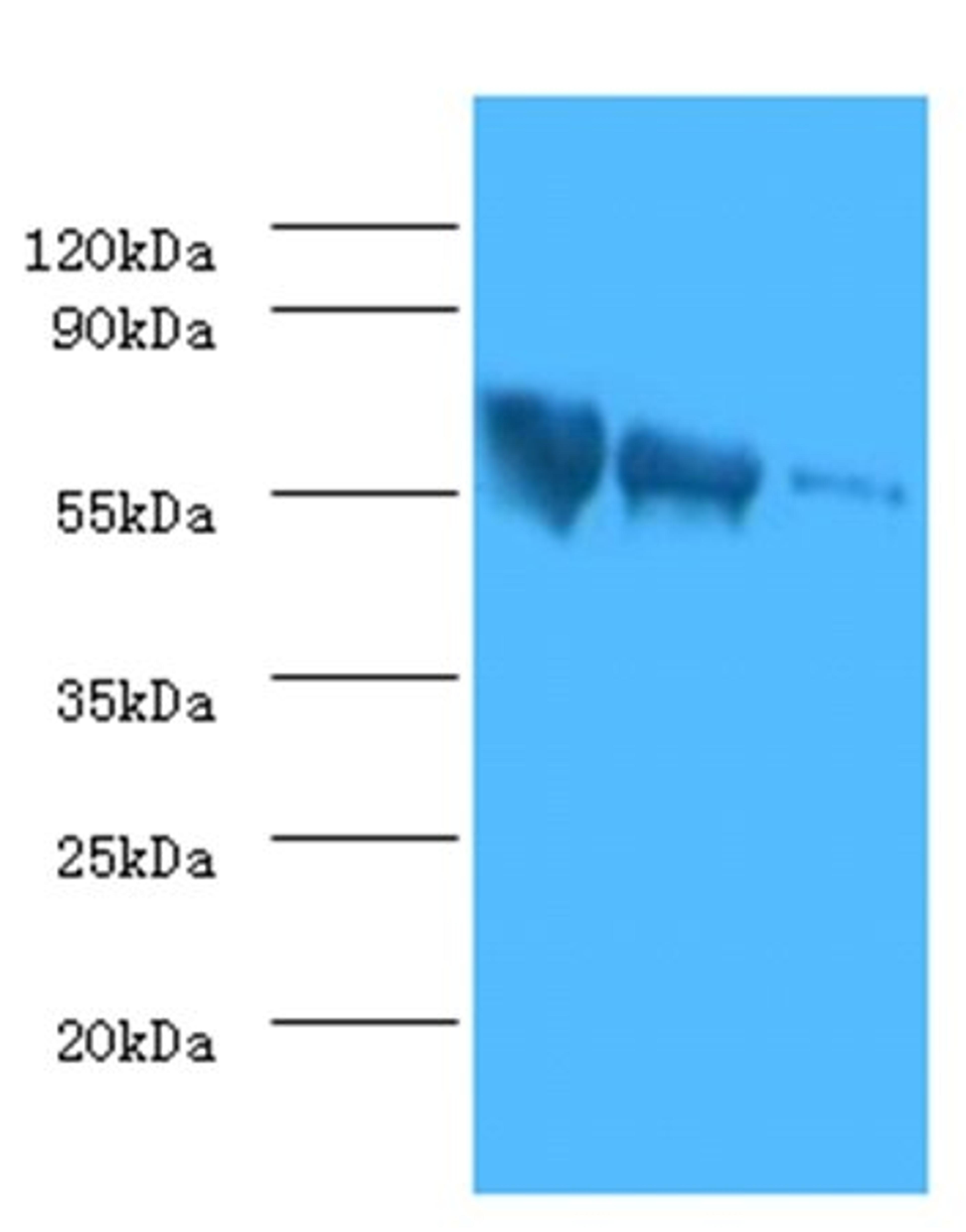 Western blot analysis of (Lane 1):Rabies virus antigen 1:2 (Lane 2):Rabies virus antigen 1:10 (Lane 3):Rabies virus antigen 1:20using Rabies virus Glycoprotein G antibody