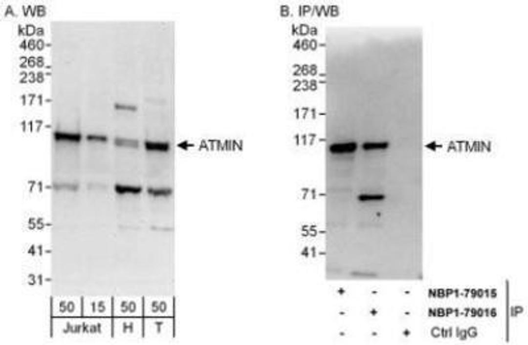 Western Blot: ASCIZ Antibody [NBP1-79016] - Whole cell lysate from Jurkat (15 and 50 mcg for WB; 1 mg for IP, 20% of IP loaded), HeLa (H; 50 mcg) and 293T (T; 50 mcg) cells.  Antibodies: Affinity purified rabbit anti-ATMIN antibody  used for WB at 0.1 mcg/ml (A) and 1 mcg/ml (B) and used for IP at 6 mcg/mg lysate.  ATMIN was also immunoprecipitated by rabbit anti-ATMIN antibody NBP1-79015 which recognizes an upstream epitope.